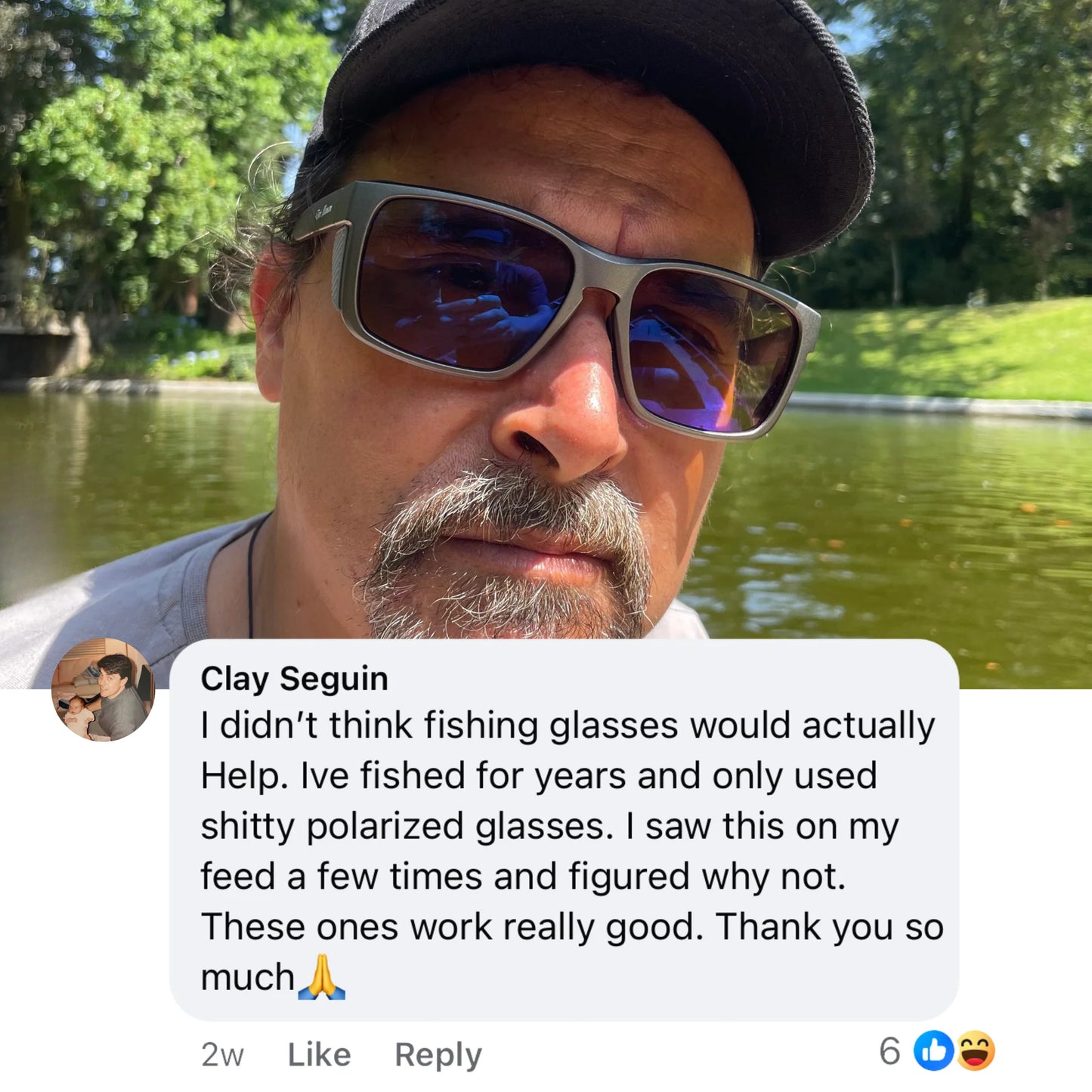 Abyzion™ Fishing Pro Sunglasses Kit